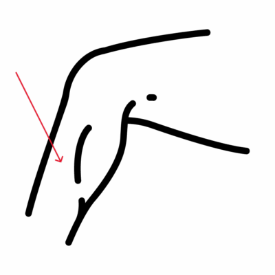 Image for choice number 18