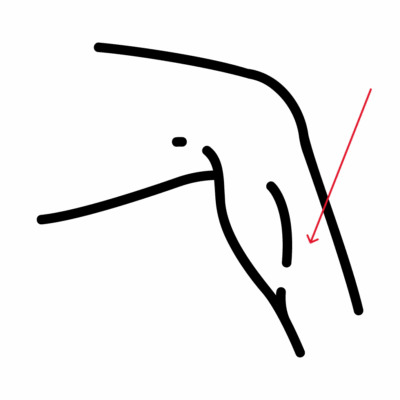 Image for choice number 17